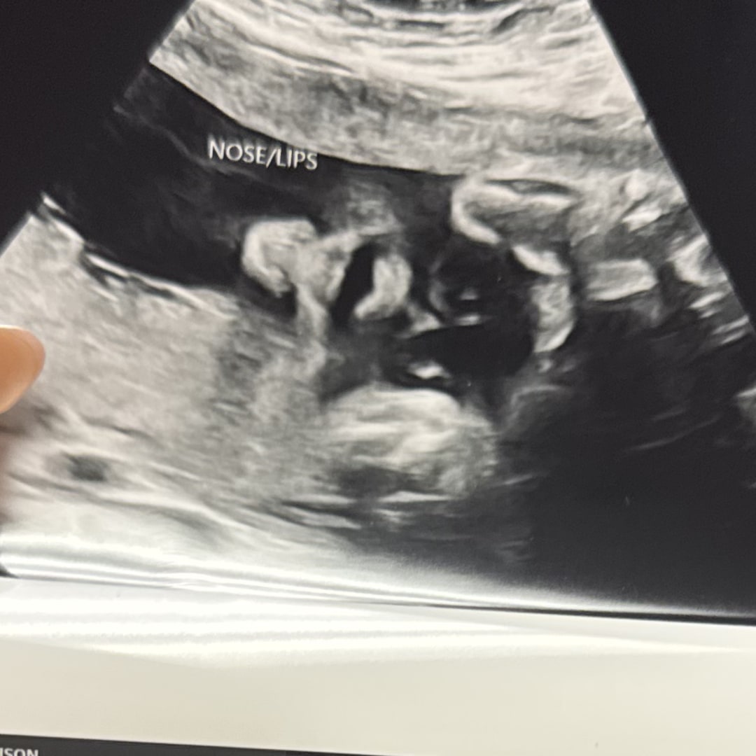 Photo shared by Madison for their Babylist baby registry.