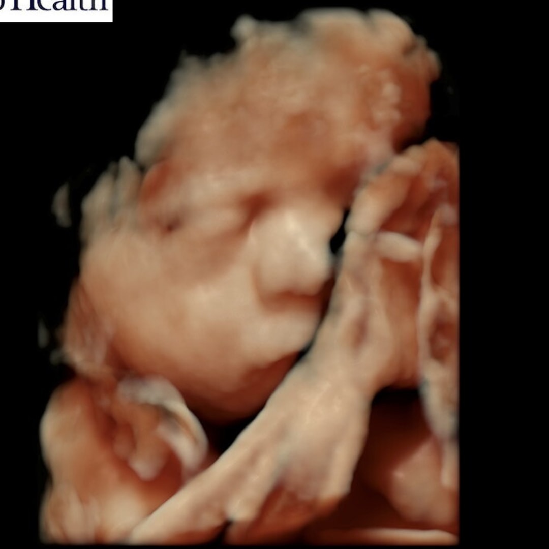 Photo shared by Anabelle for their Babylist baby registry.