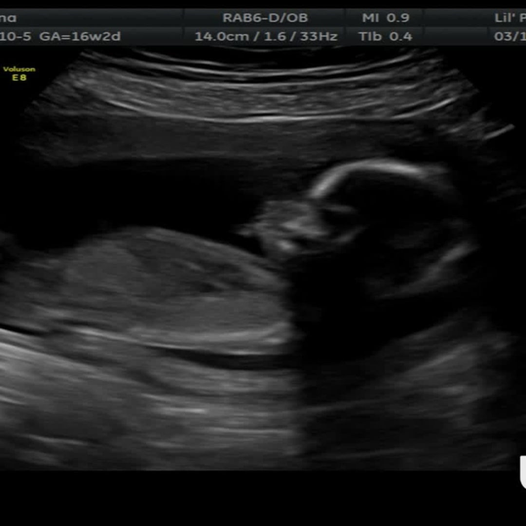 Photo shared by Justina for their Babylist baby registry.