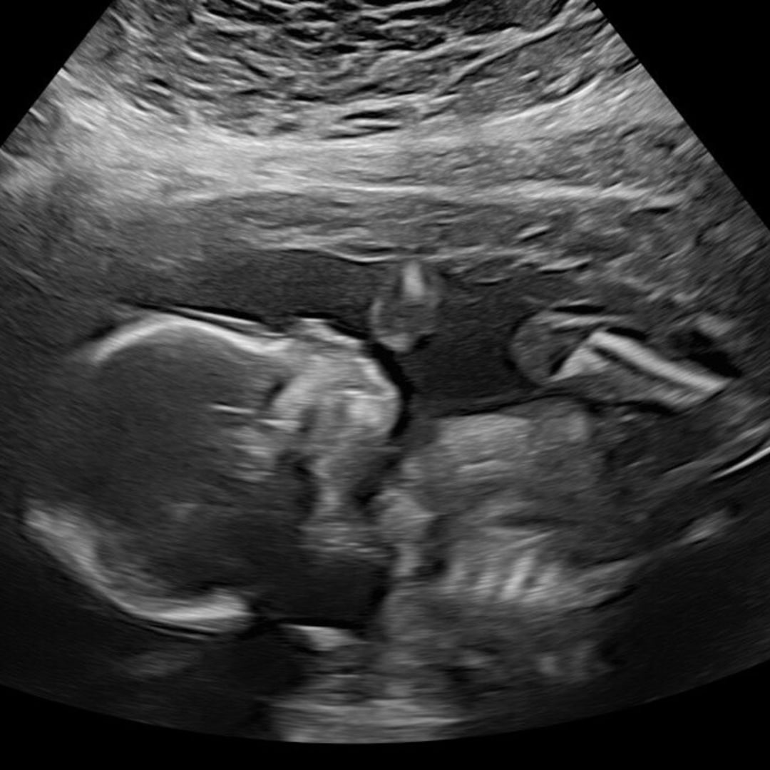 Photo shared by Jalissa for their Babylist baby registry.