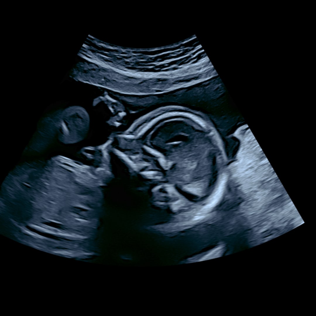 Photo shared by Hollee for their Babylist baby registry.