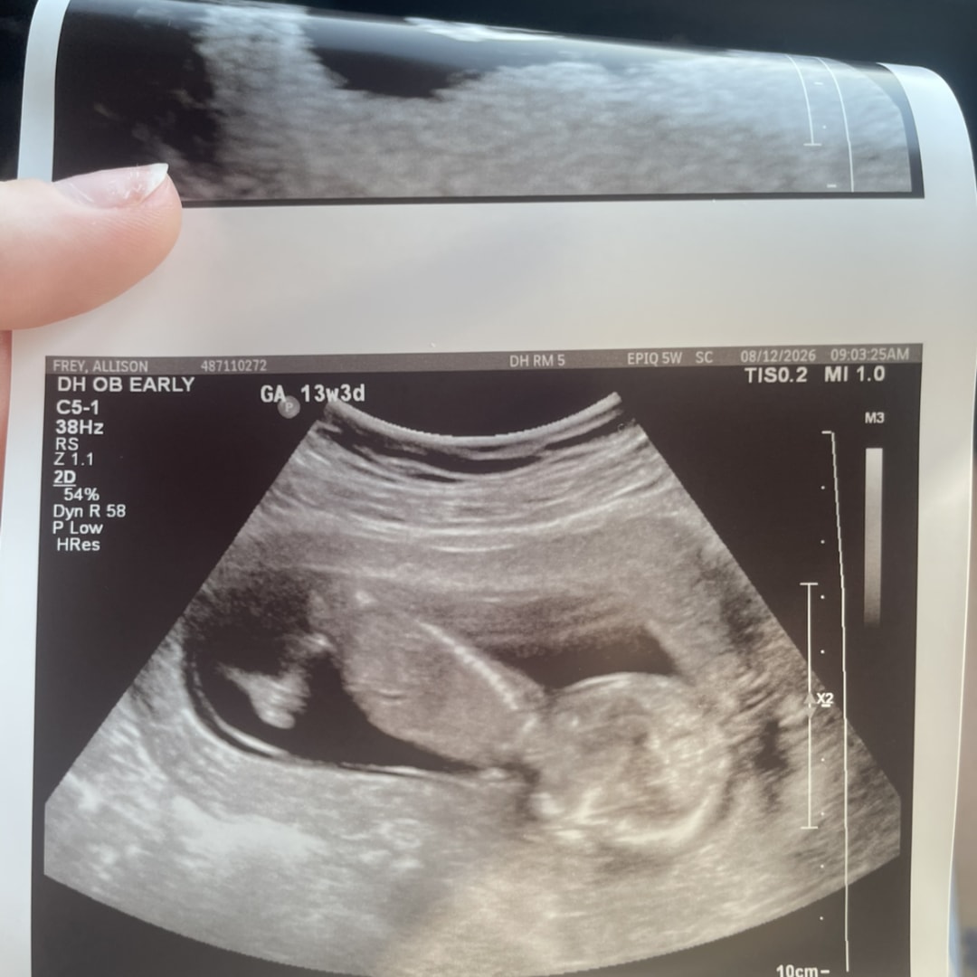 Photo shared by Alli for their Babylist baby registry.