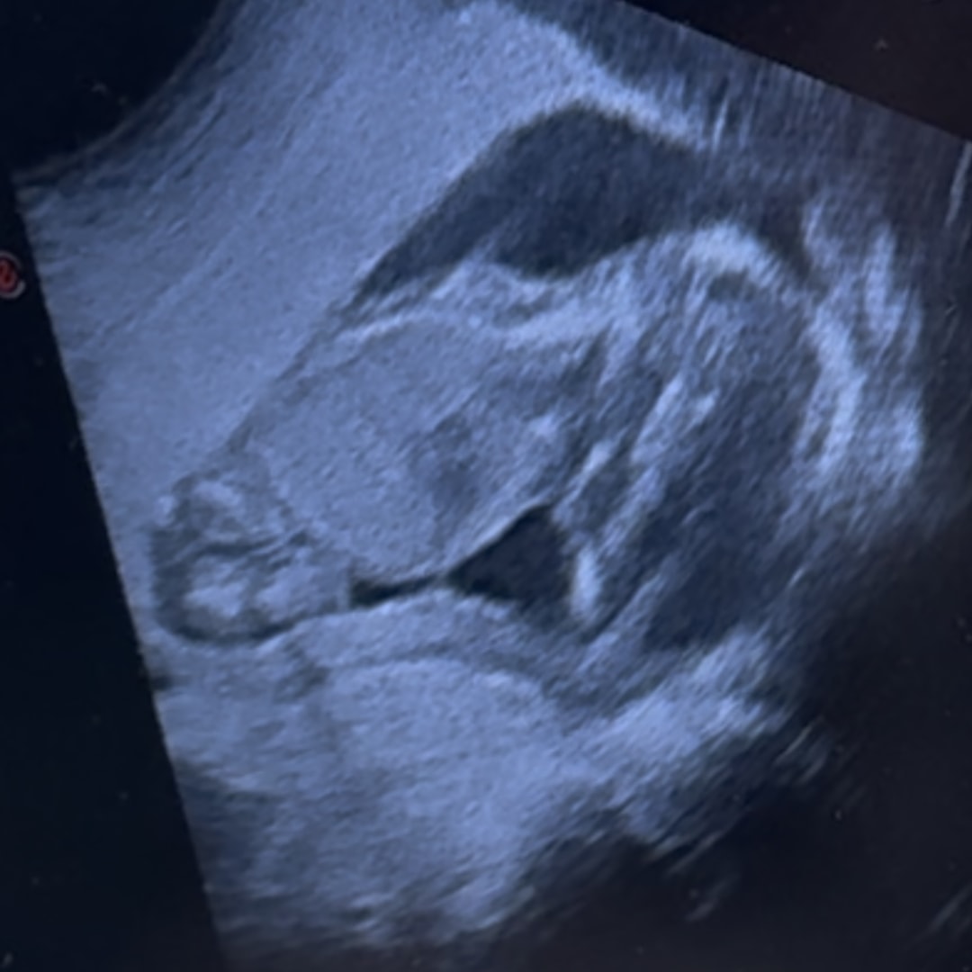 Photo shared by Abigayil for their Babylist baby registry.
