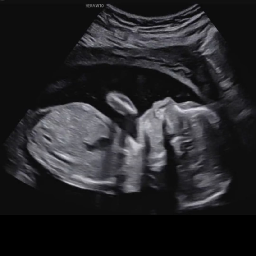 Photo shared by Mackenzie for their Babylist baby registry.