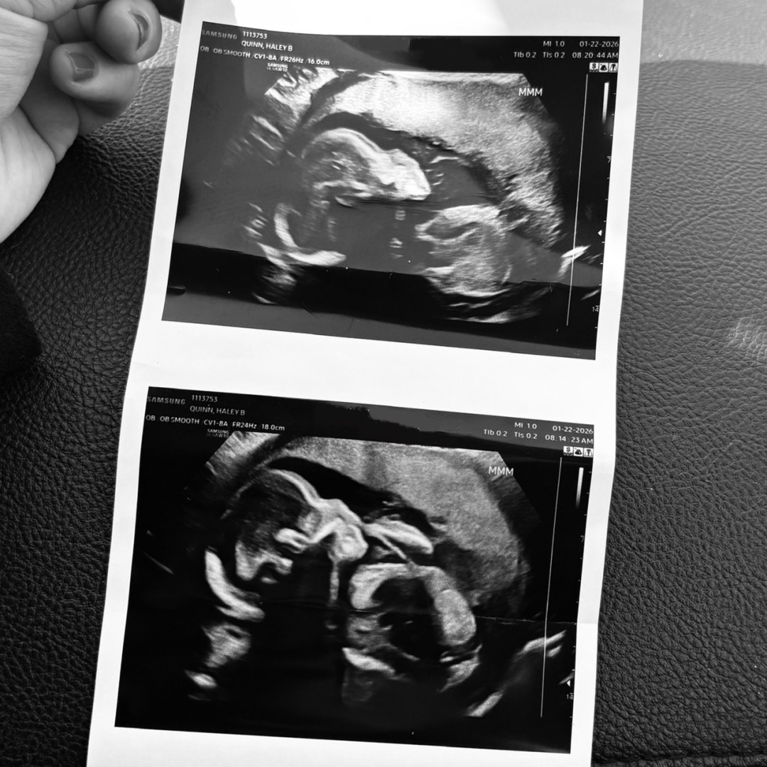 Photo shared by Haley for their Babylist baby registry.