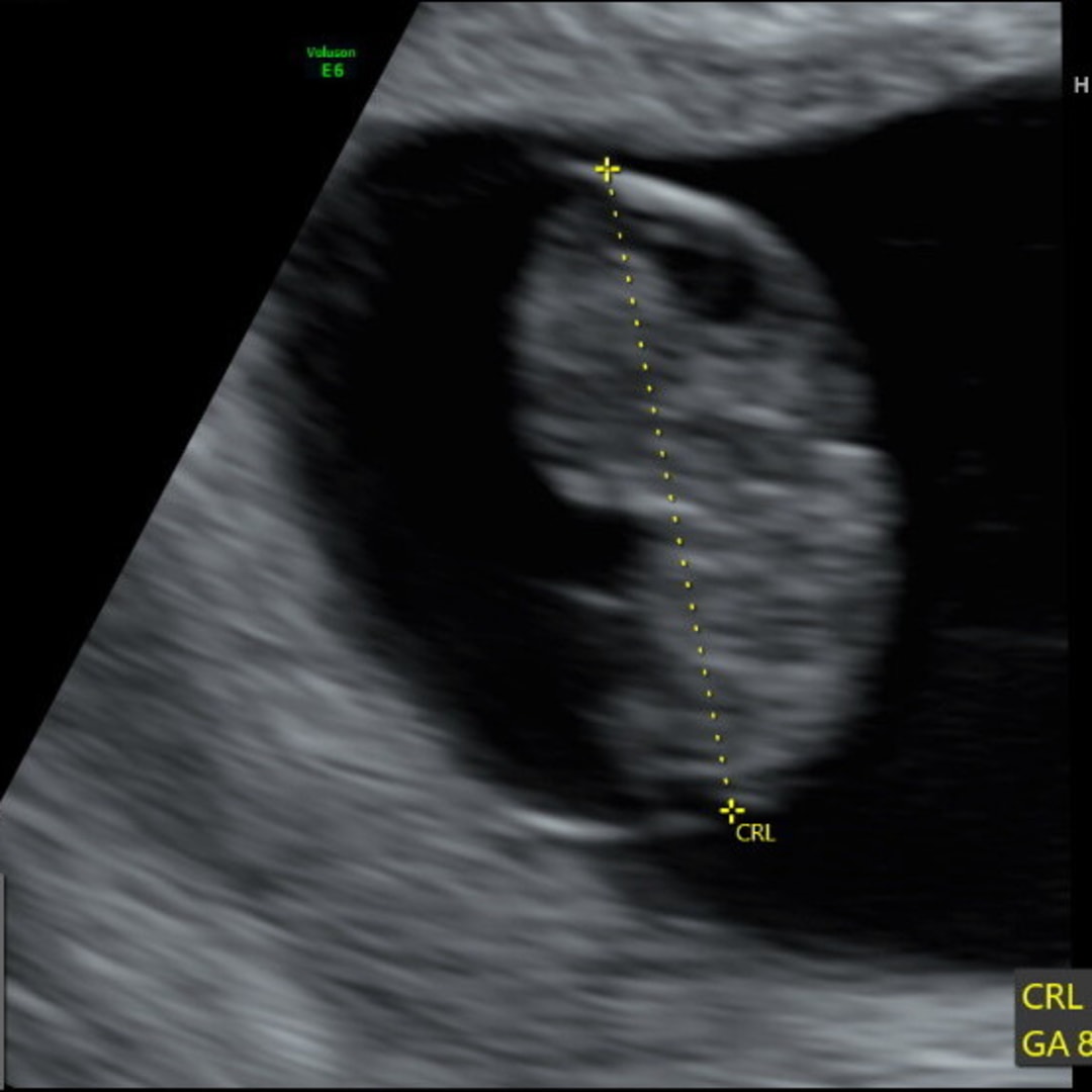 Photo shared by Allie for their Babylist baby registry.