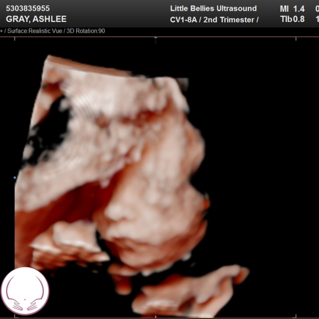 Photo shared by Ashlee for their Babylist baby registry.