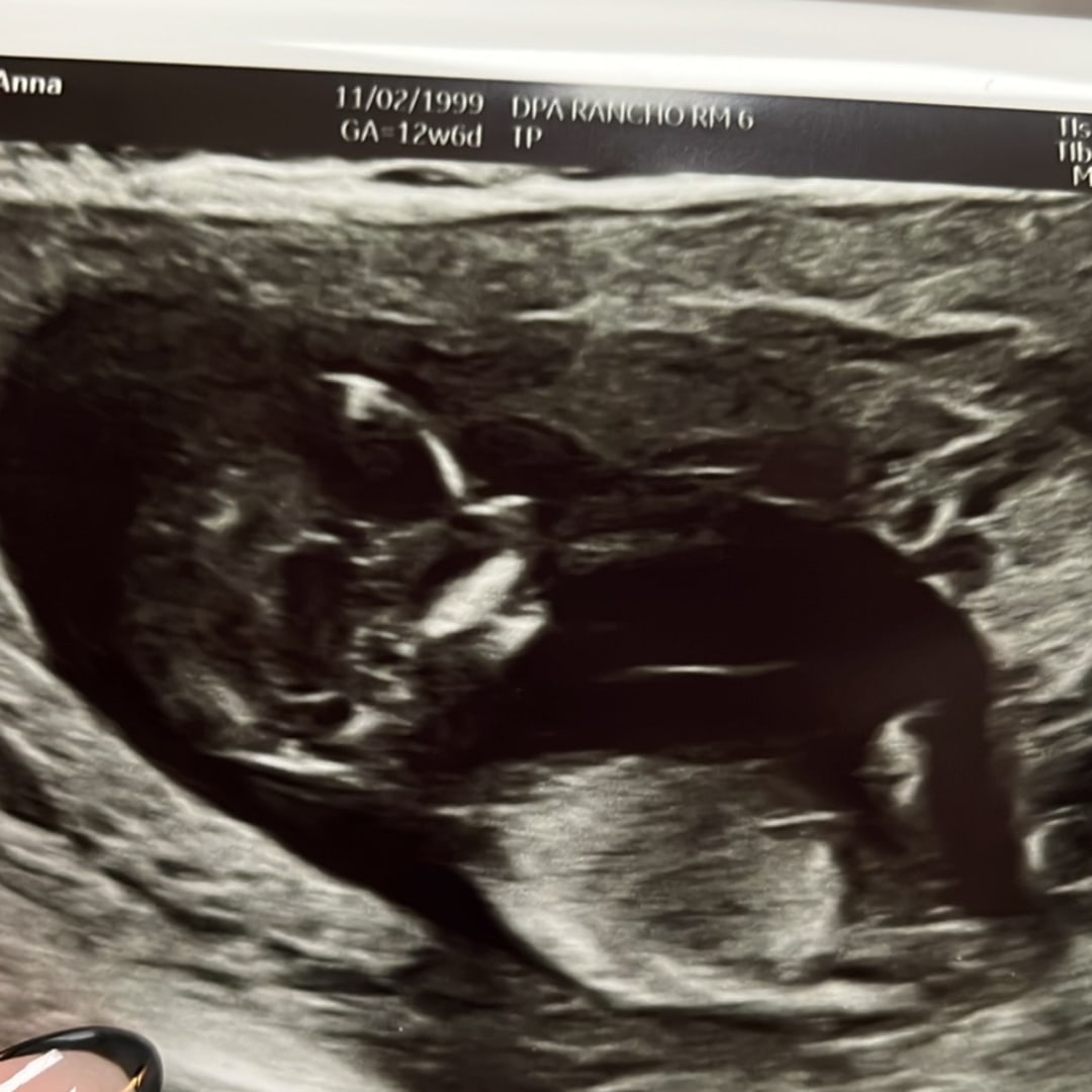 Photo shared by Anna for their Babylist baby registry.