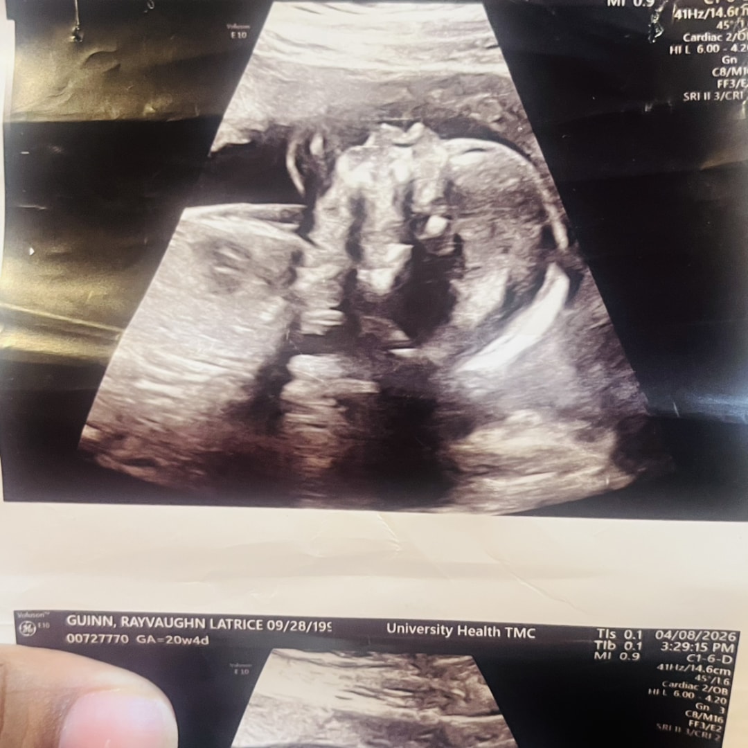 Photo shared by Latrice for their Babylist baby registry.