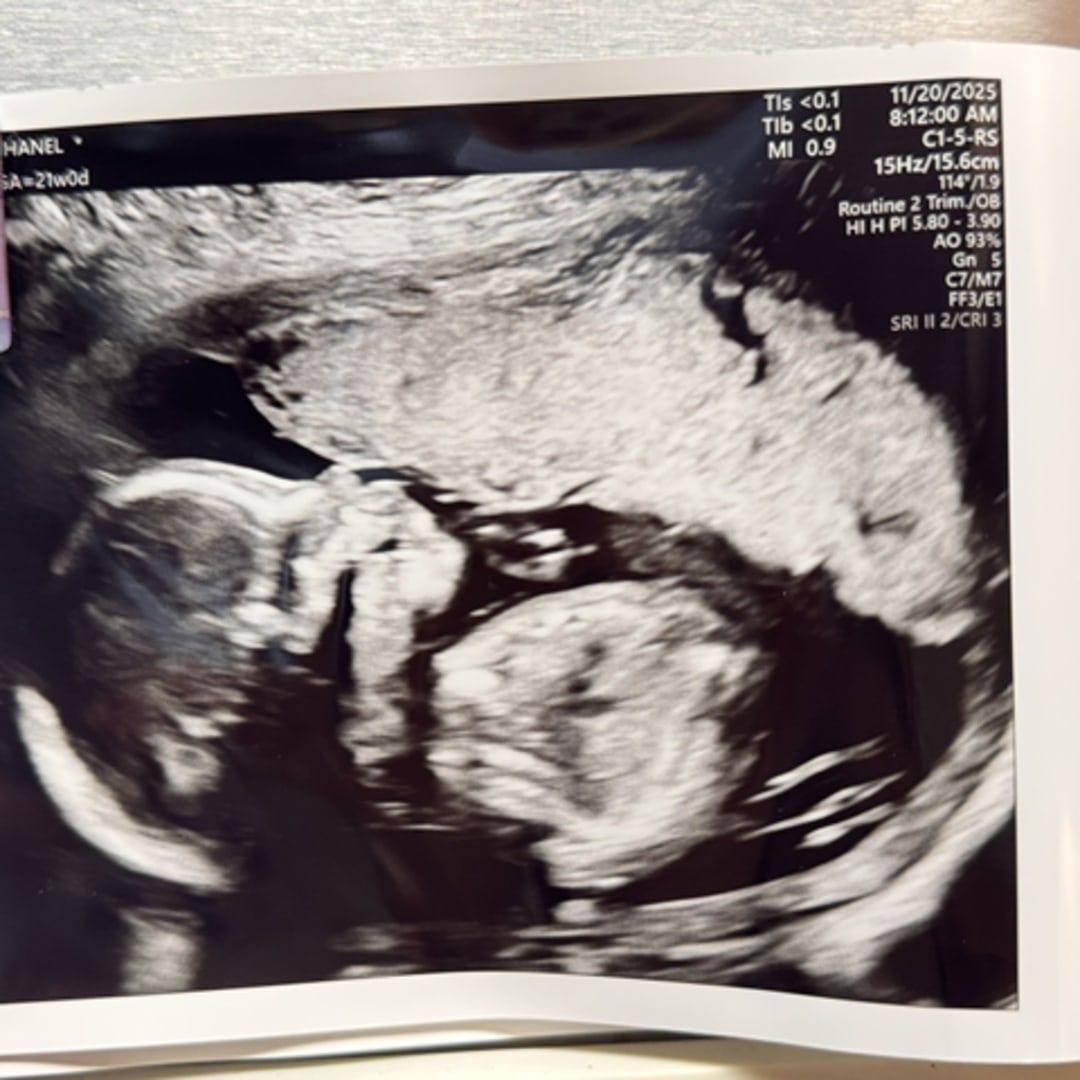 Photo shared by Chanel for their Babylist baby registry.