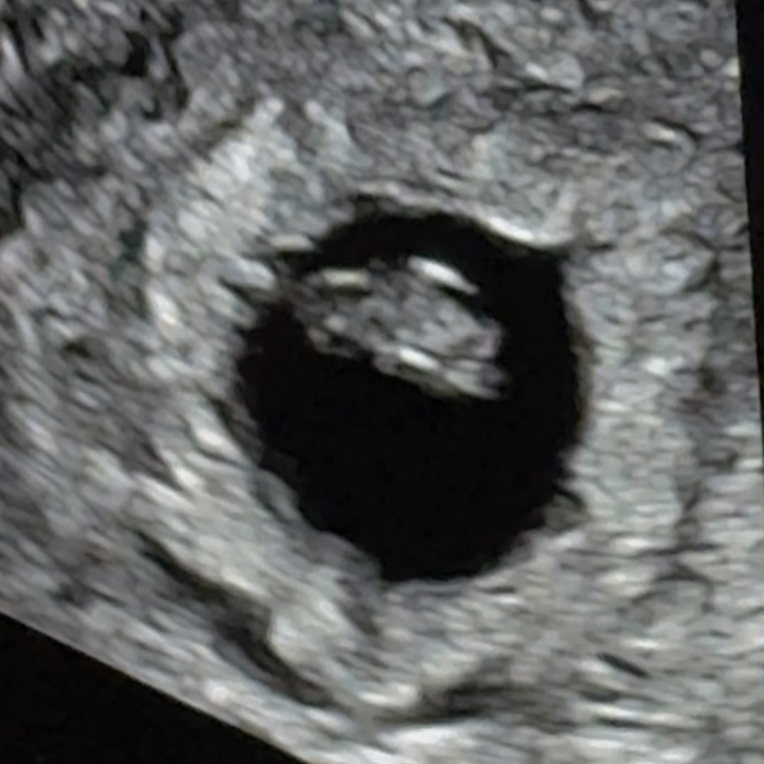 Photo shared by Jaclyn for their Babylist baby registry.