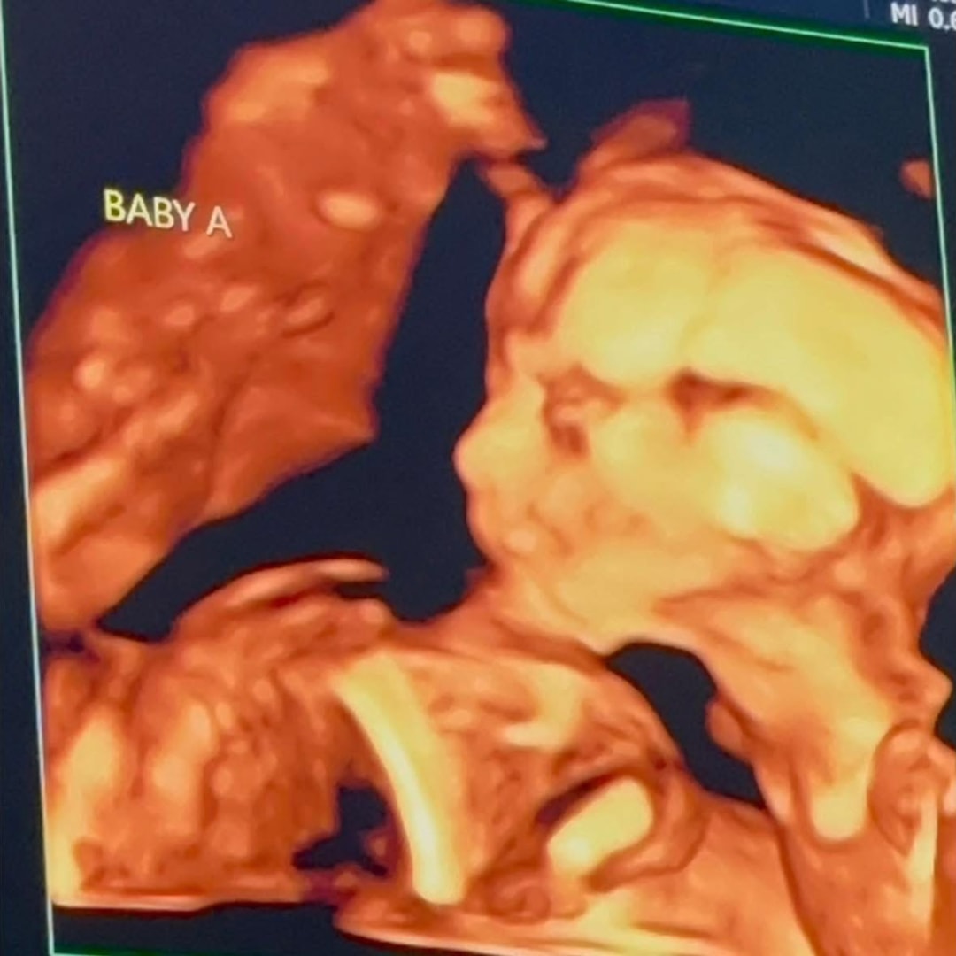 Photo shared by Kait for their Babylist baby registry.