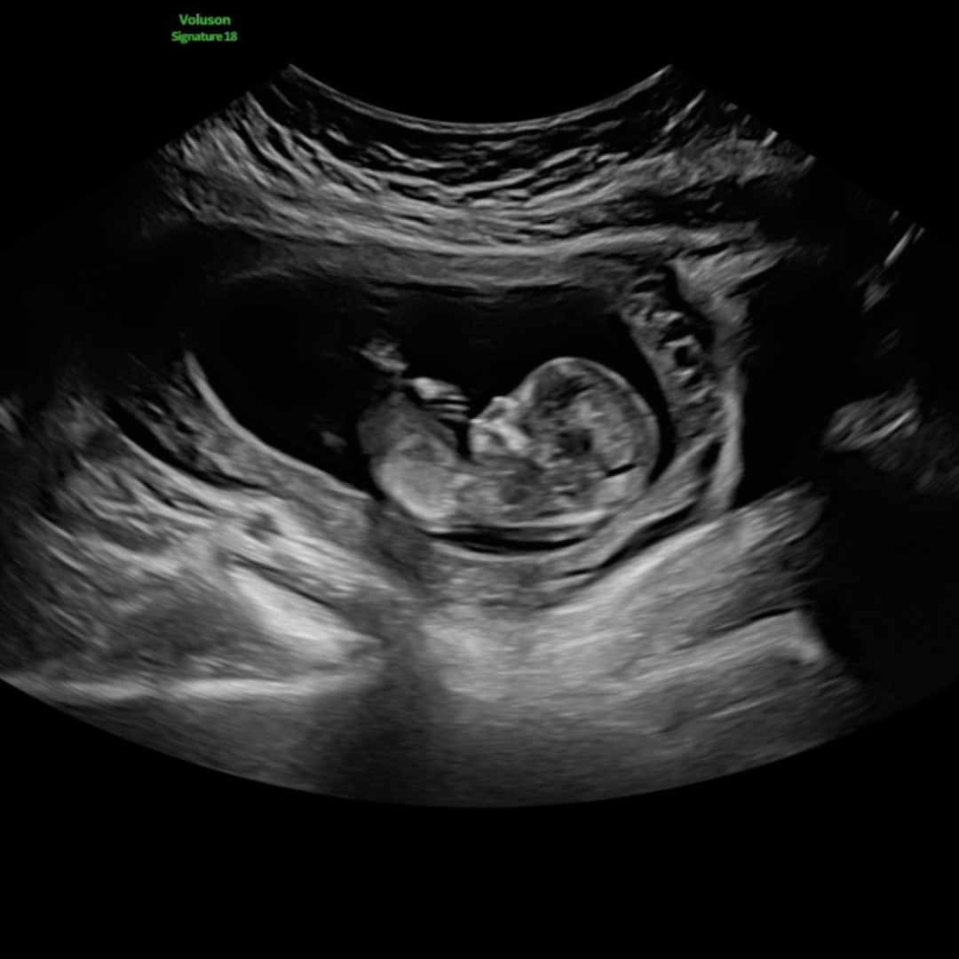 Photo shared by Taina for their Babylist baby registry.