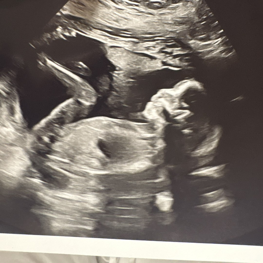 Photo shared by Missy for their Babylist baby registry.
