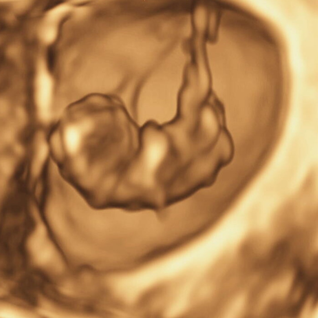 Photo shared by Jenna for their Babylist baby registry.