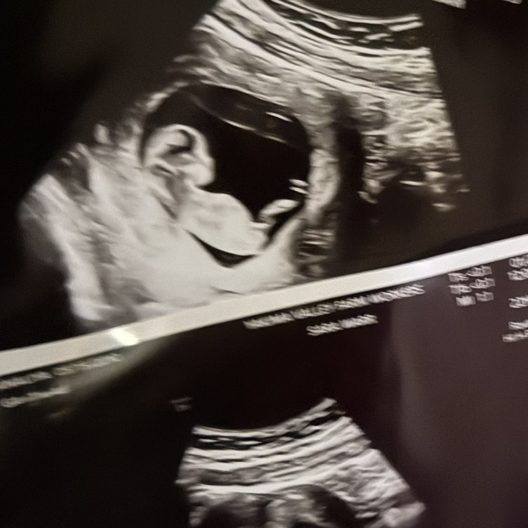 Photo shared by Analiyah for their Babylist baby registry.