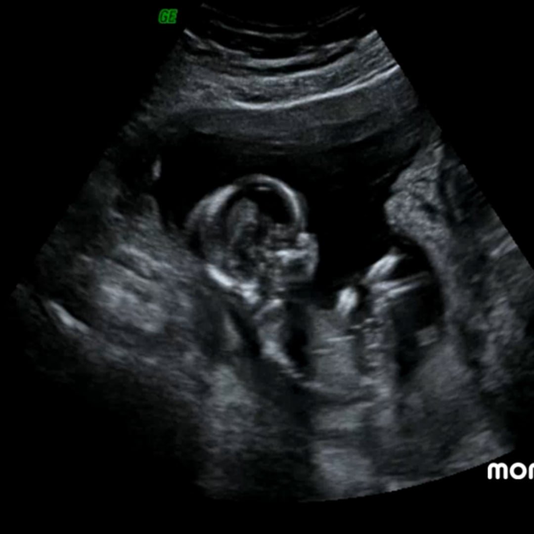 Photo shared by Leonela for their Babylist baby registry.