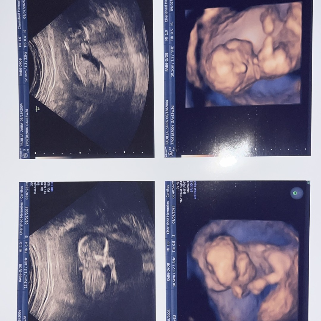 Photo shared by Zaira for their Babylist baby registry.