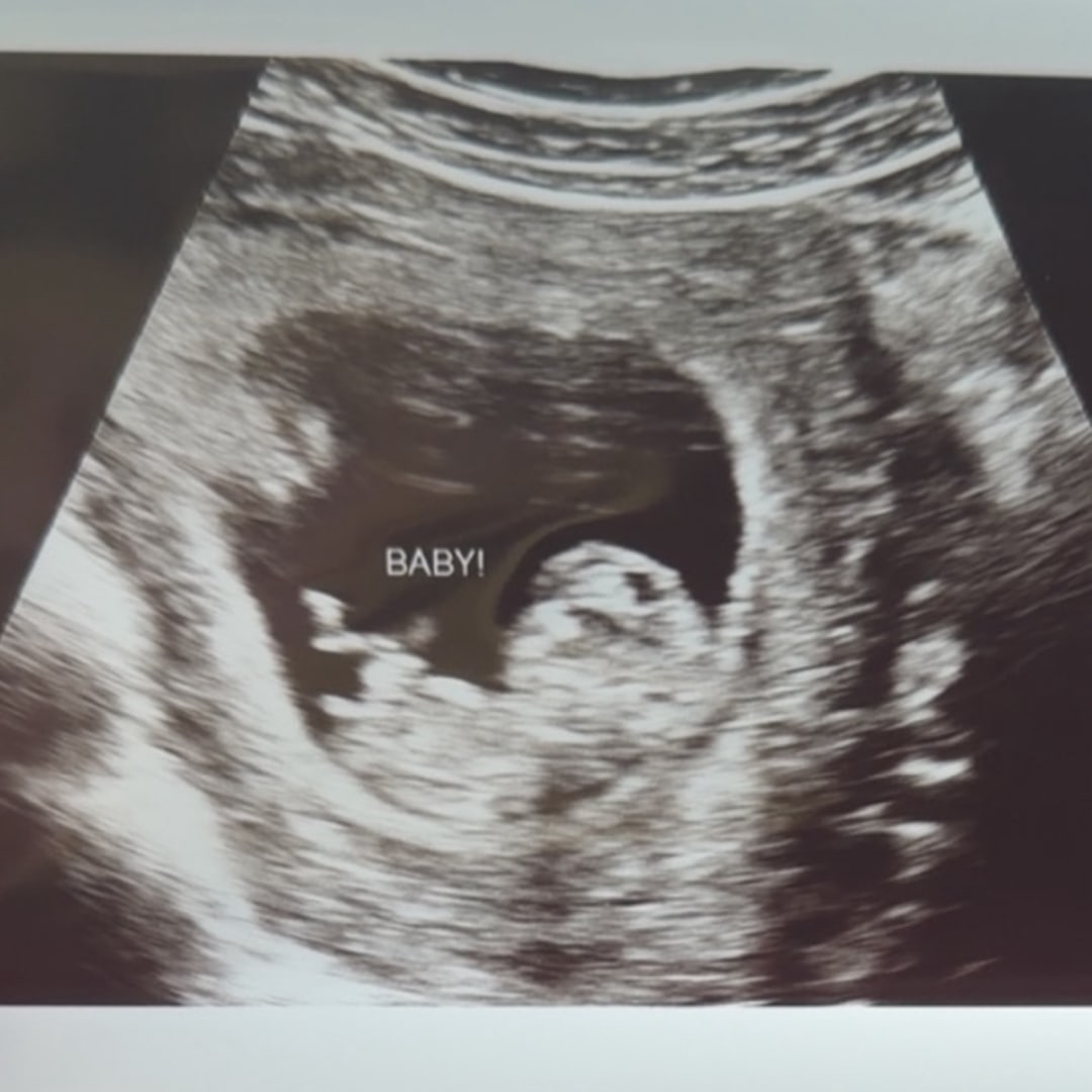 Photo shared by Averi for their Babylist baby registry.