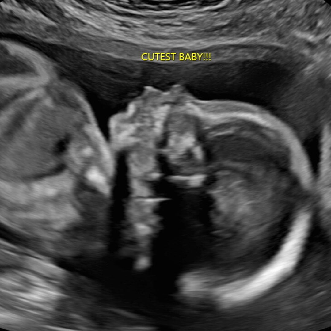 Photo shared by Matti and Zach for their Babylist baby registry.