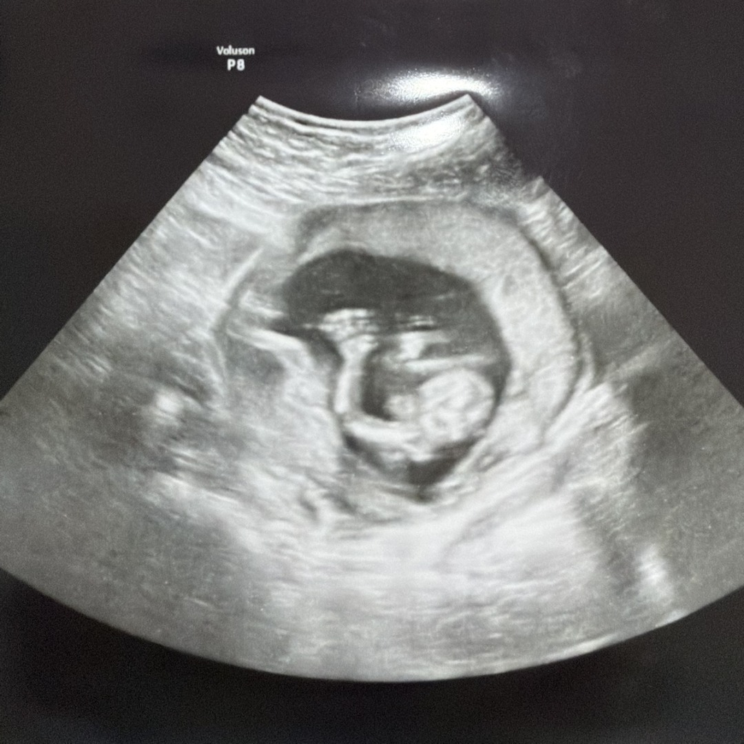Photo shared by Caitlin for their Babylist baby registry.