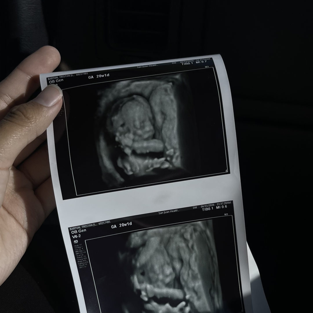 Photo shared by Tristan for their Babylist baby registry.