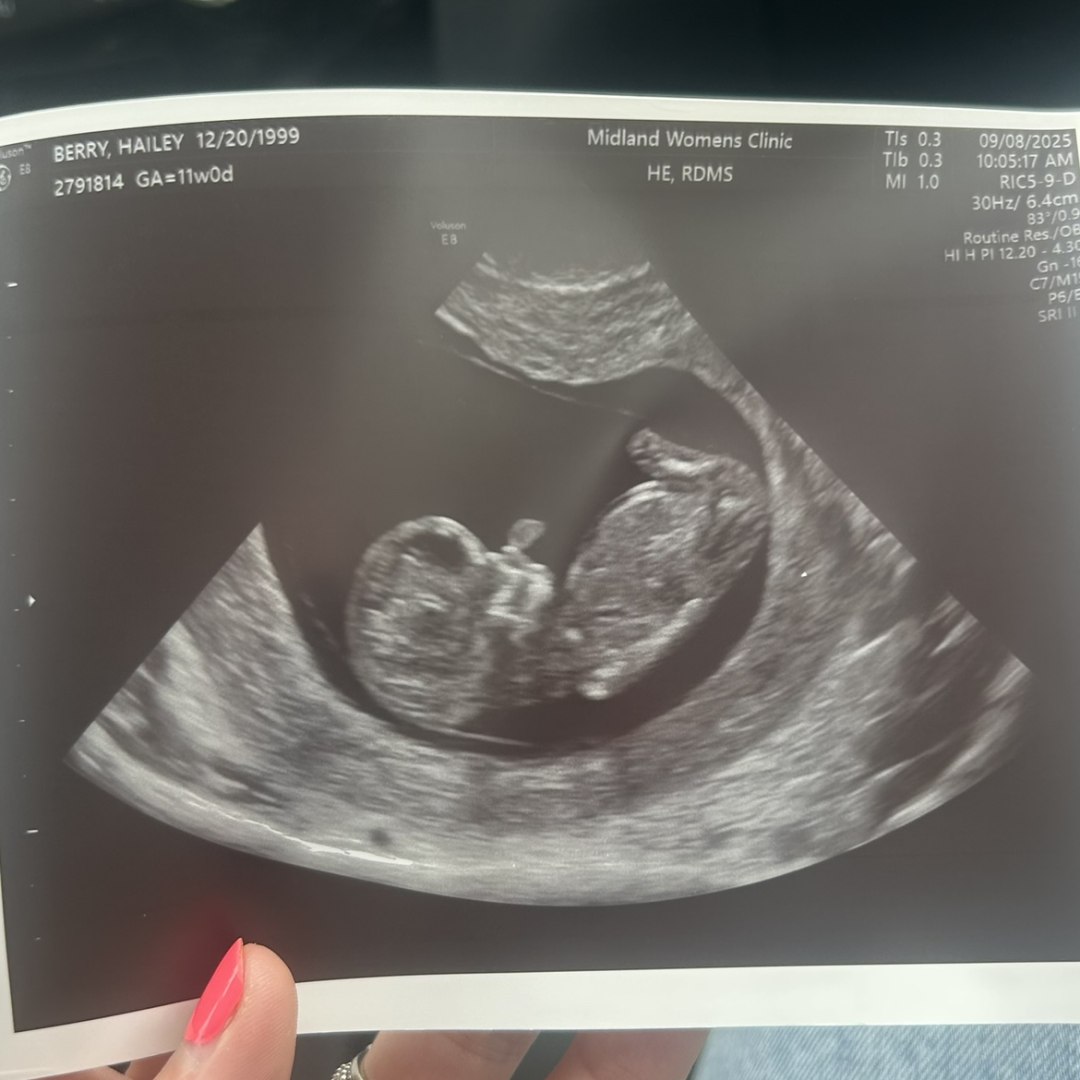 Photo shared by Hailey for their Babylist baby registry.