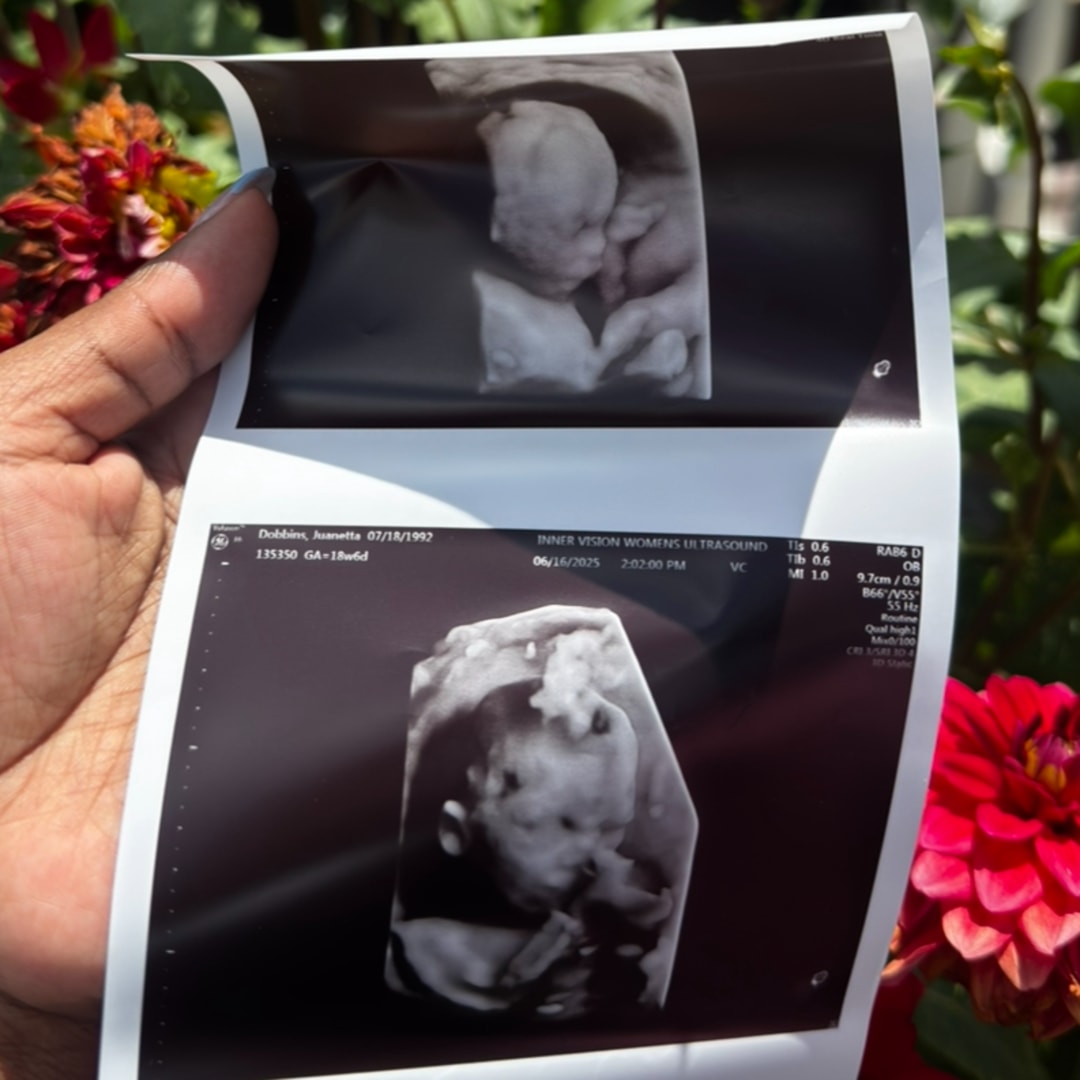 Photo shared by Netta for their Babylist baby registry.