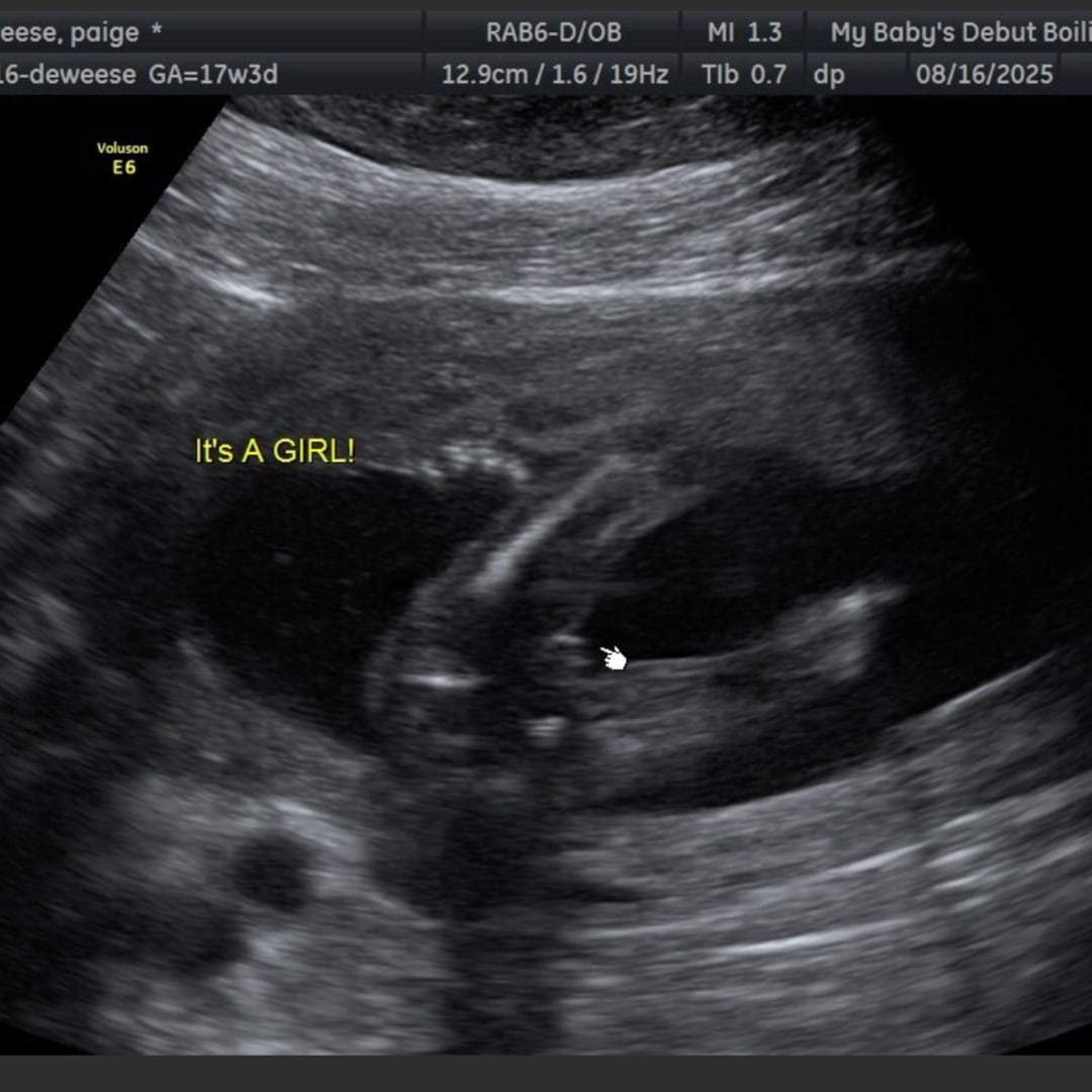 Photo shared by Koke for their Babylist baby registry.