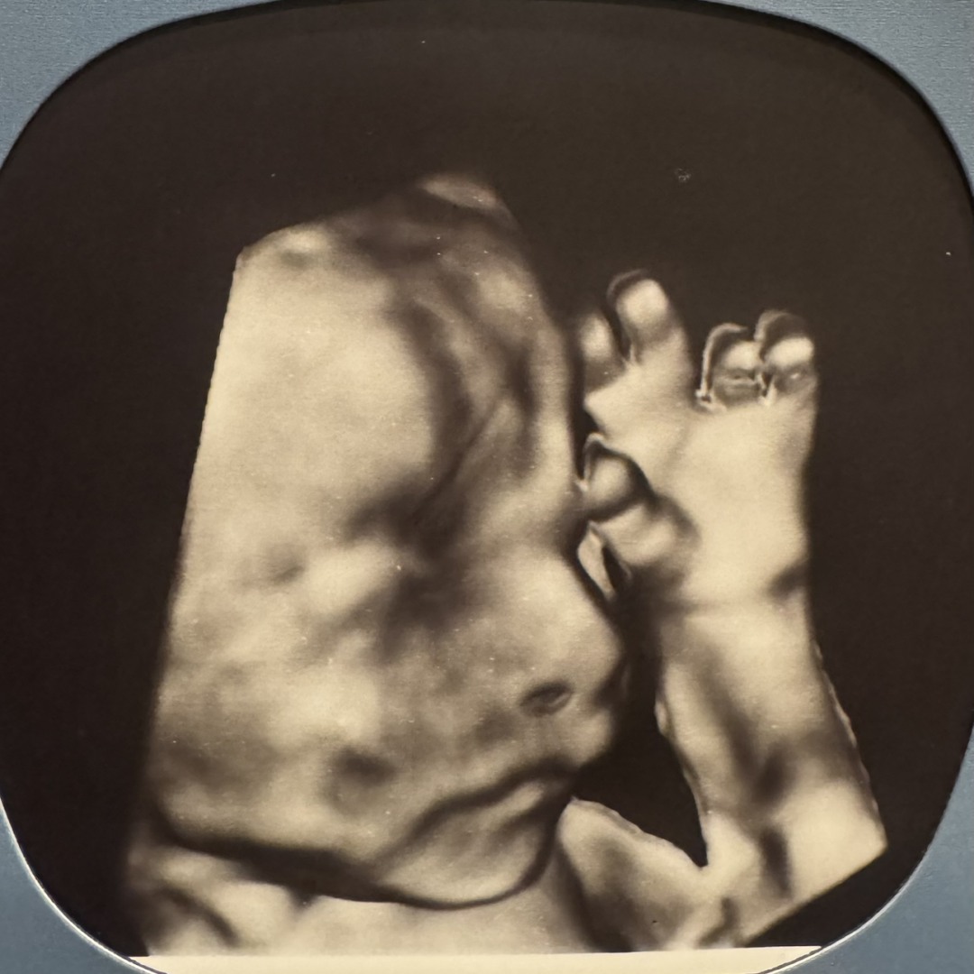 Photo shared by Jesse for their Babylist baby registry.