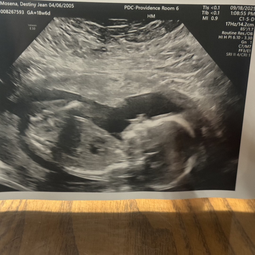 Photo shared by Destiny for their Babylist baby registry.