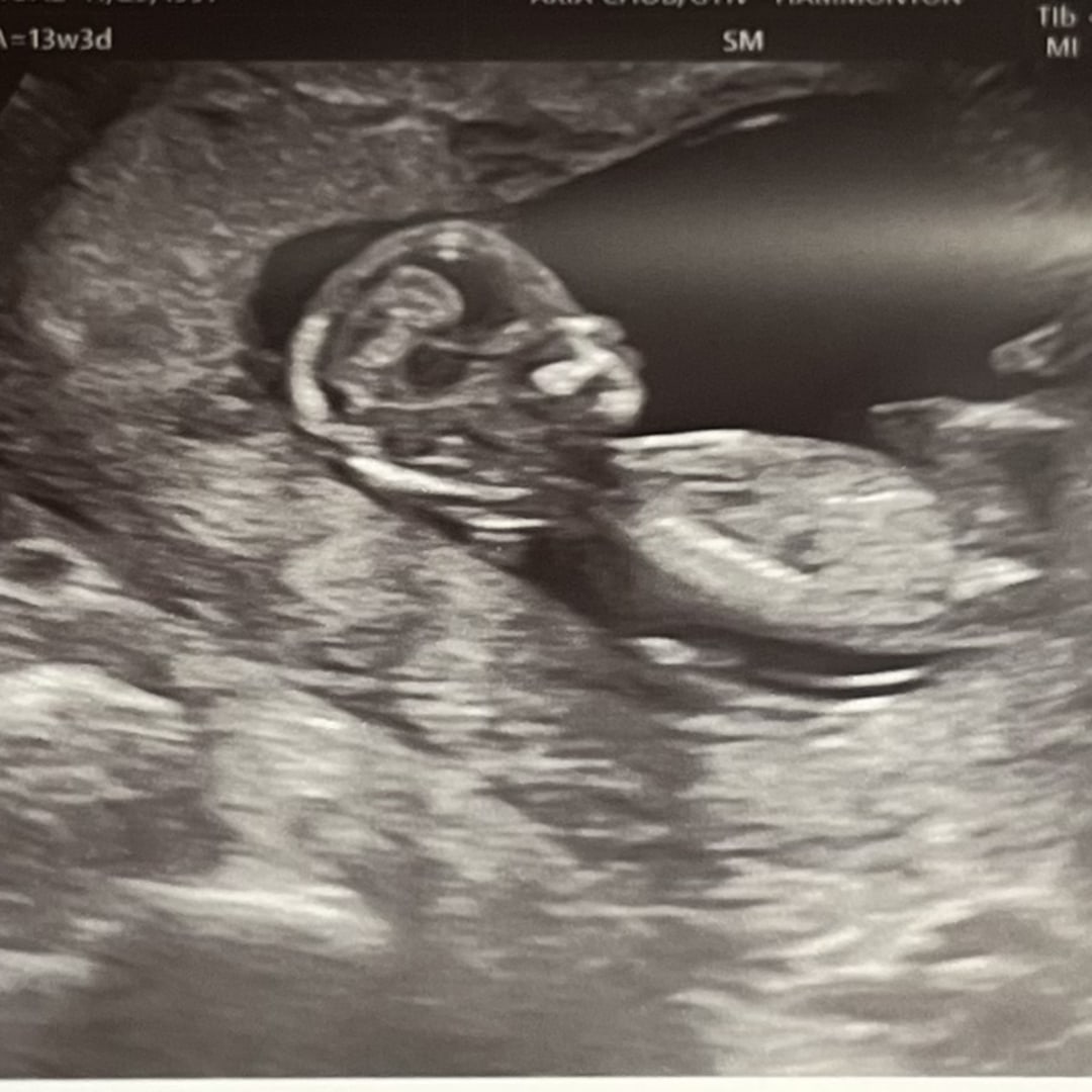 Photo shared by Nichoal for their Babylist baby registry.