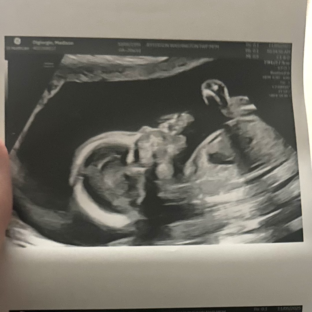 Photo shared by Madison for their Babylist baby registry.