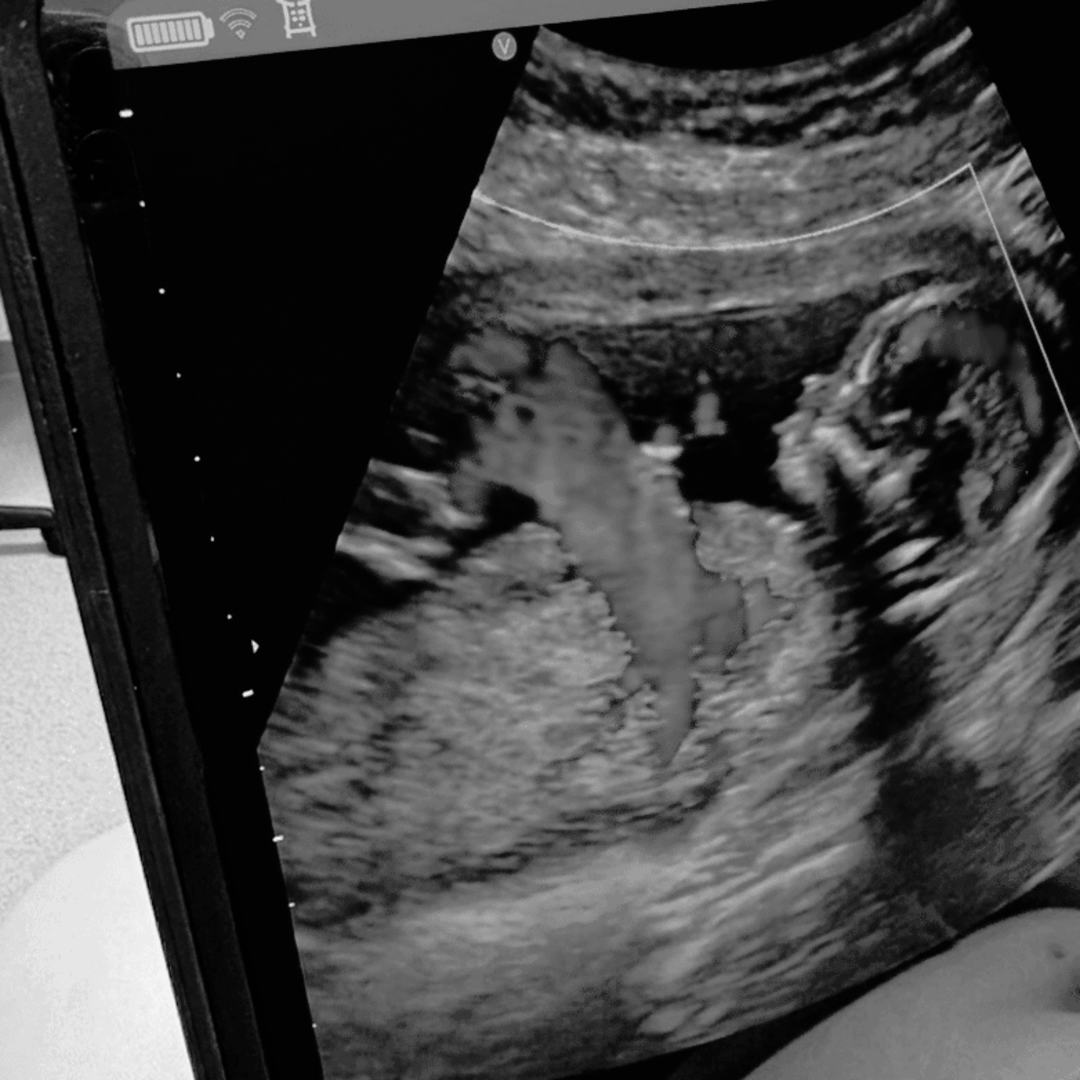 Photo shared by Erynne for their Babylist baby registry.