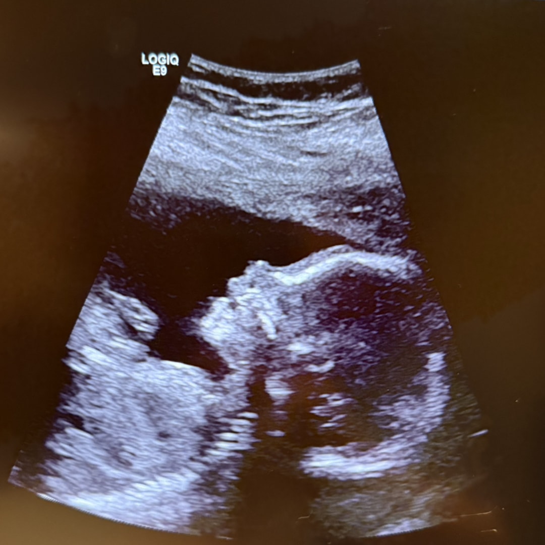 Photo shared by Carly for their Babylist baby registry.
