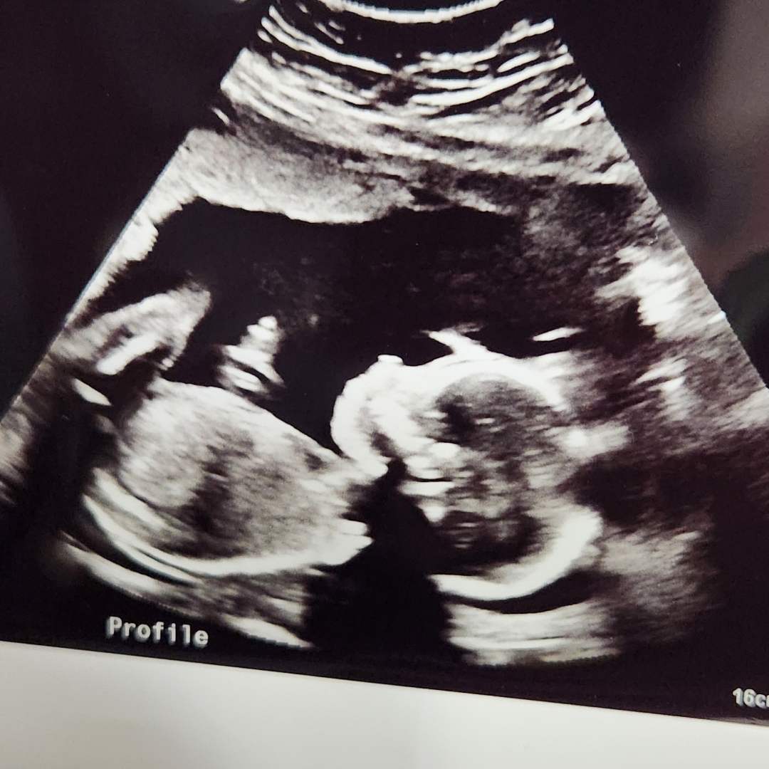 Photo shared by Brie for their Babylist baby registry.