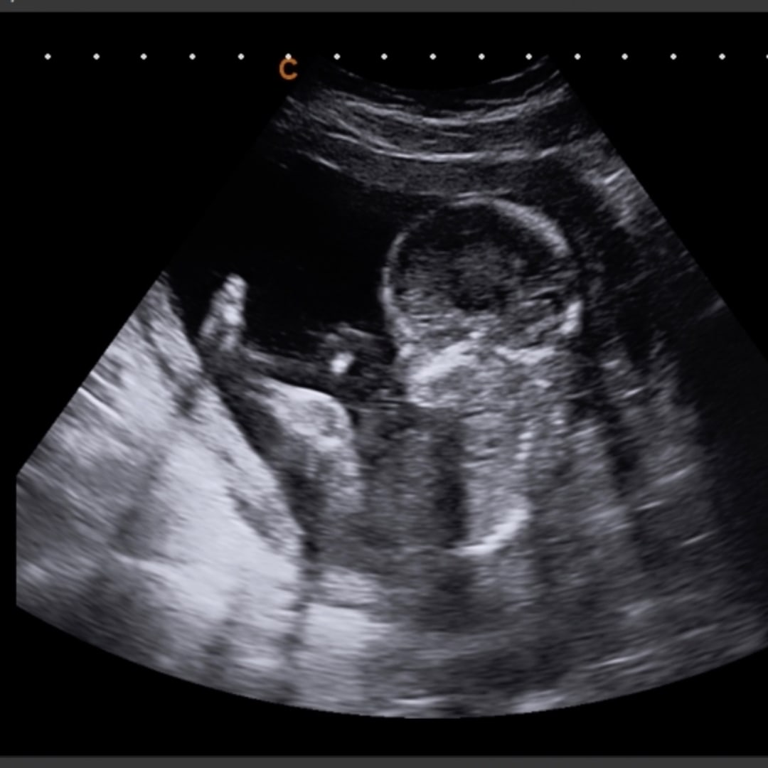 Photo shared by Jordan for their Babylist baby registry.