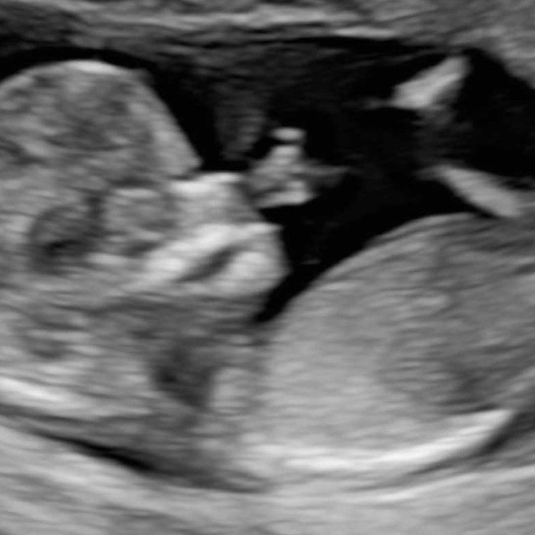 Photo shared by Sarah for their Babylist baby registry.