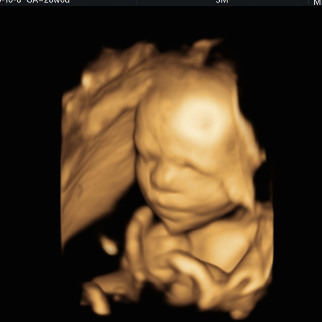 Photo shared by Michelle for their Babylist baby registry.