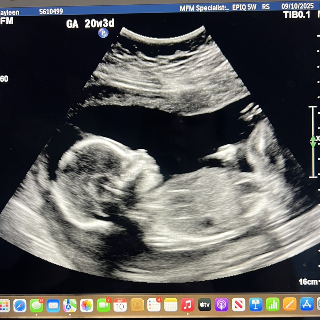 Photo shared by Kayleen for their Babylist baby registry.