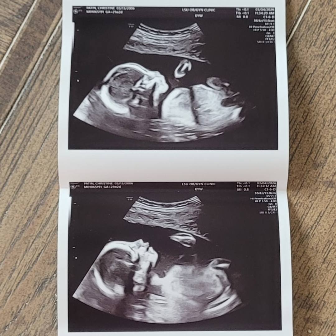 Photo shared by Christine for their Babylist baby registry.