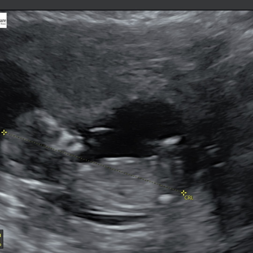 Photo shared by Kaitlyn for their Babylist baby registry.