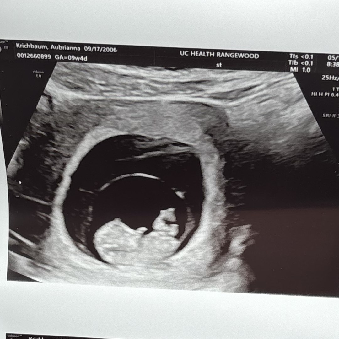 Photo shared by Aubri for their Babylist baby registry.
