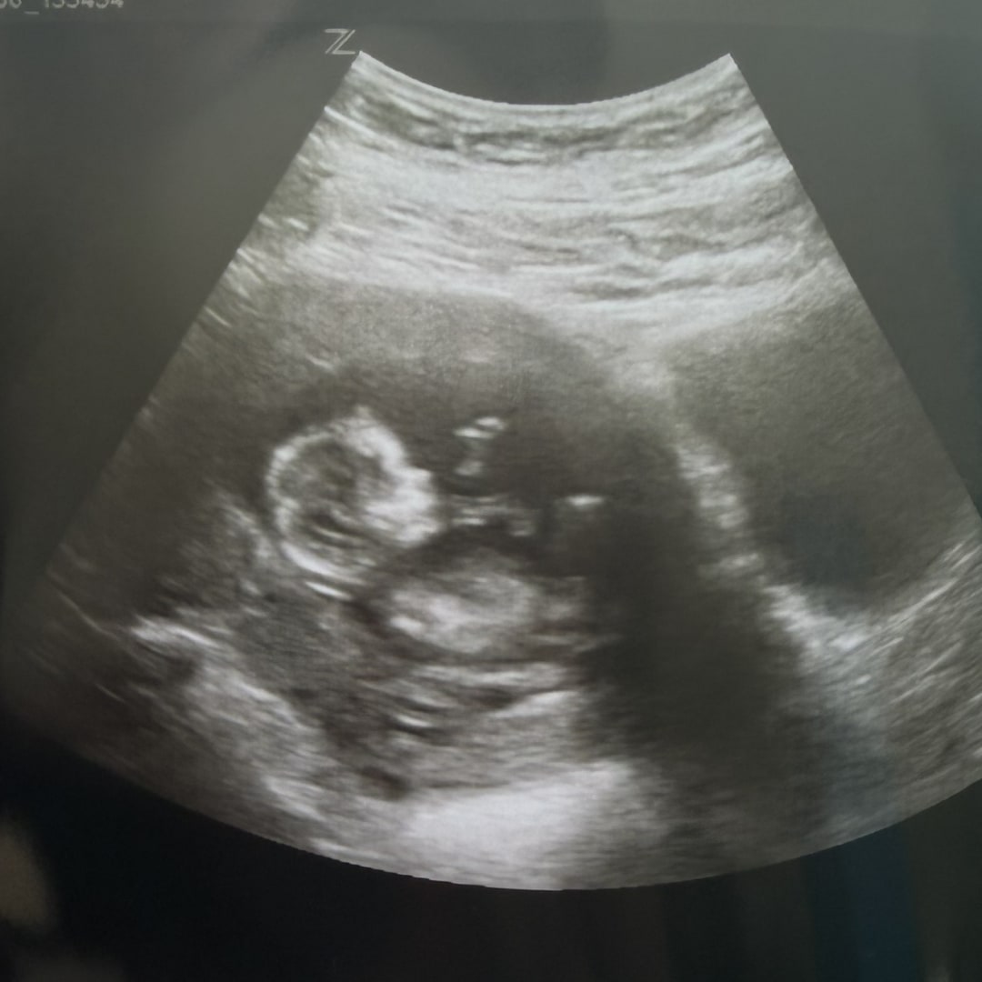Photo shared by Neily for their Babylist baby registry.