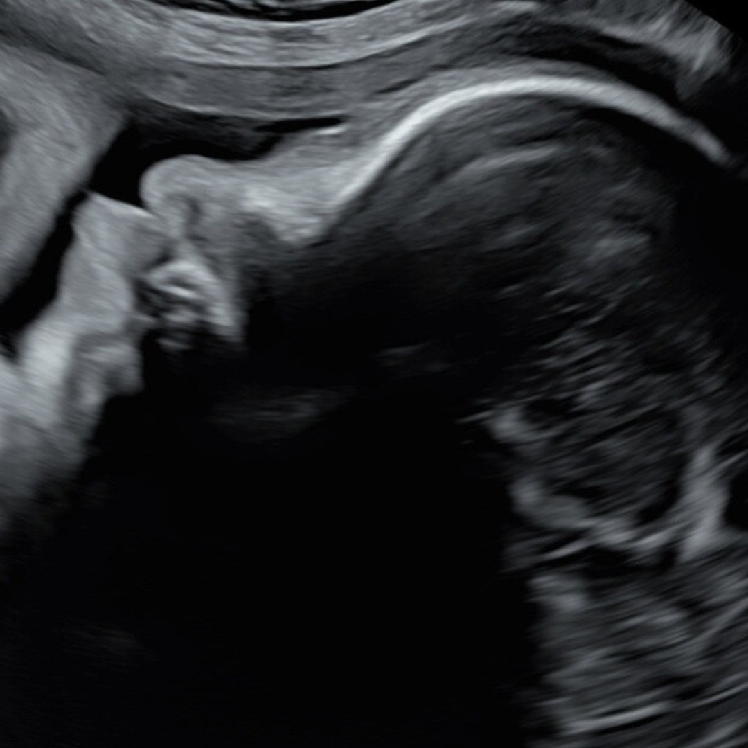 Photo shared by Jessica for their Babylist baby registry.