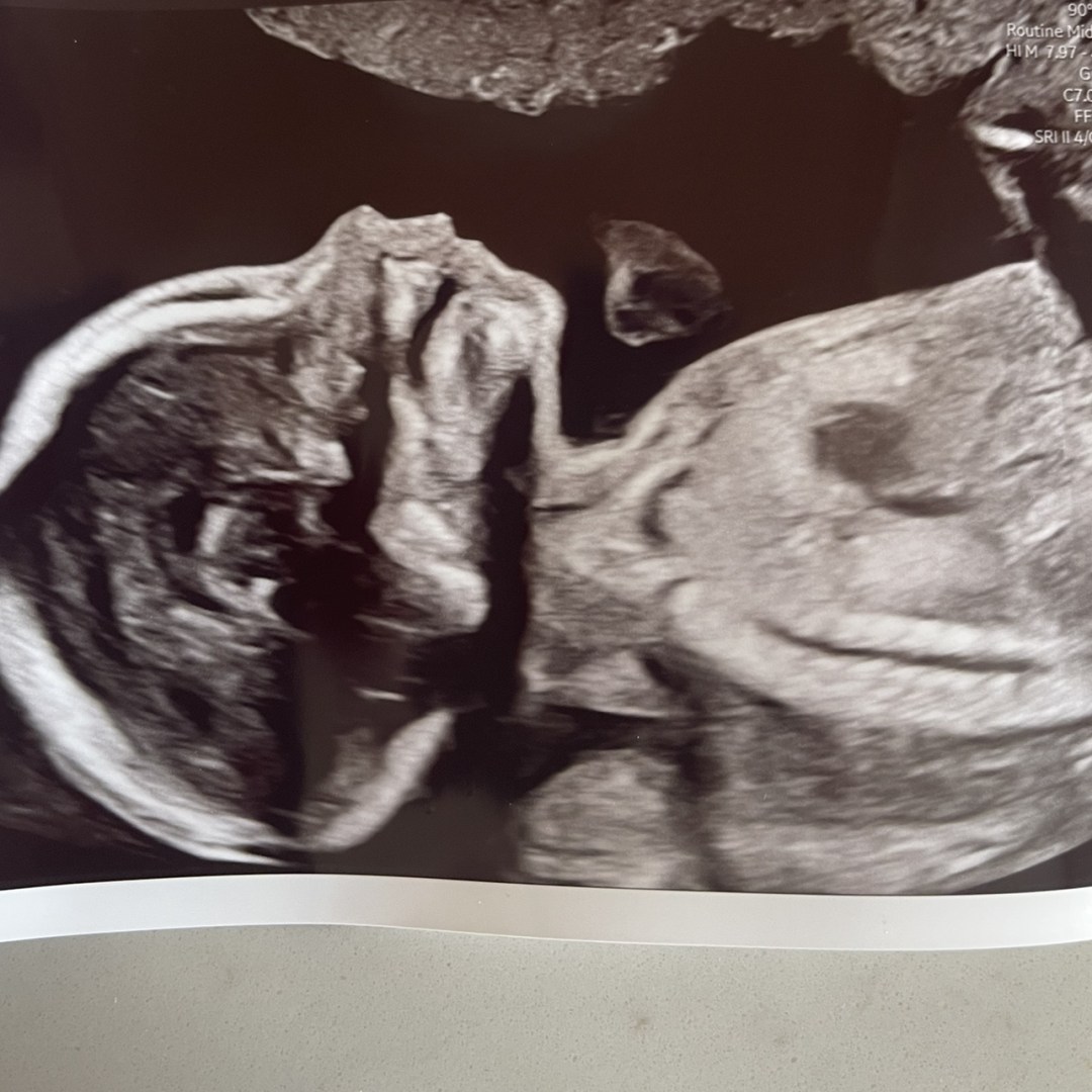 Photo shared by Destiny for their Babylist baby registry.