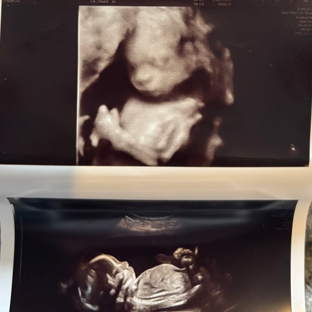 Photo shared by Amanda for their Babylist baby registry.
