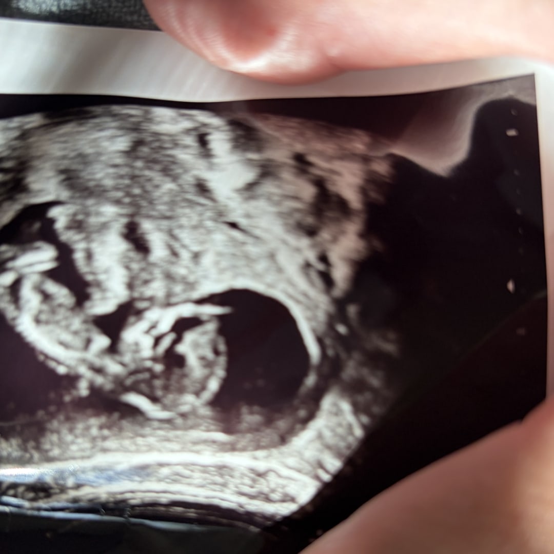 Photo shared by Damaris for their Babylist baby registry.
