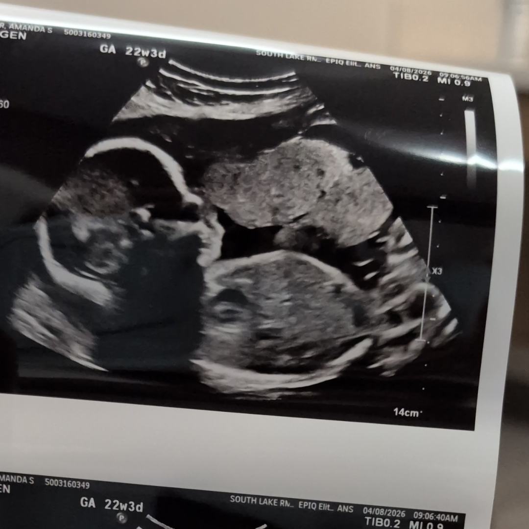 Photo shared by Amanda for their Babylist baby registry.