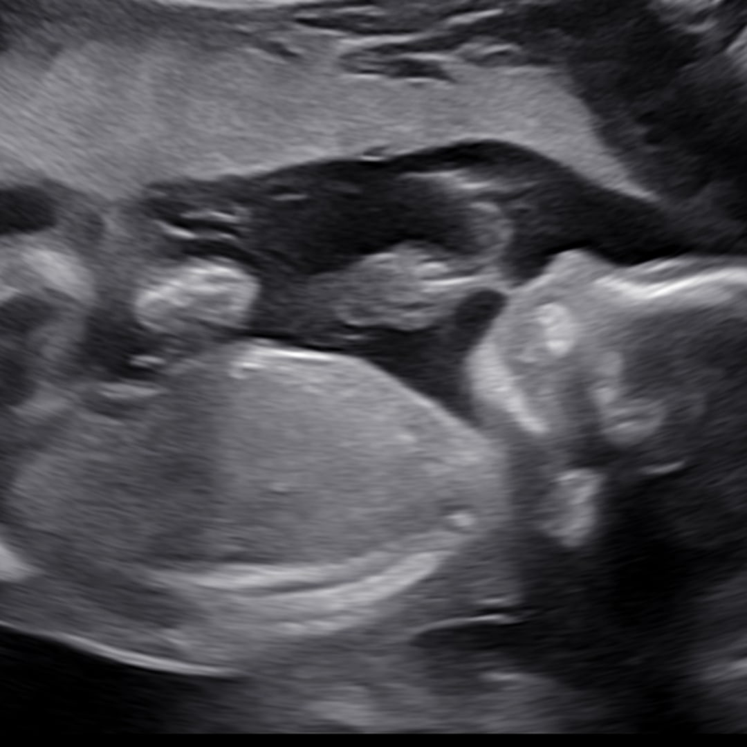 Photo shared by Jordan for their Babylist baby registry.